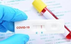 ¿Cuánto cuesta un test de antígenos?