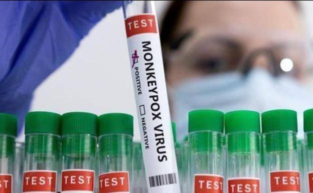 Andalusia registers 58 active cases of monkeypox and adds 1,263 people vaccinated