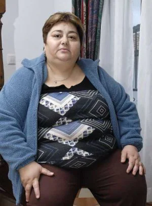 Obesos esperan de dos años para operados | Diario Sur